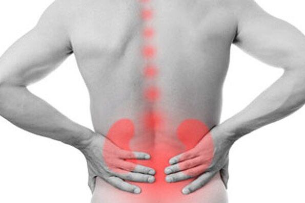 Kidney pathologies can cause lower back pain