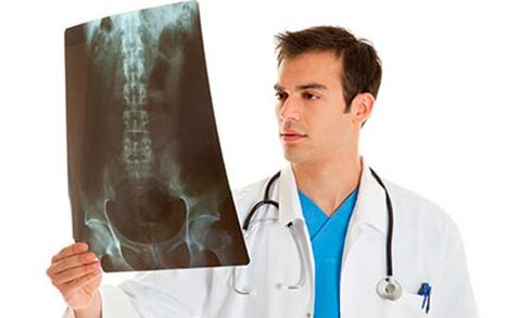 a doctor looks at an x-ray to diagnose lower back pain